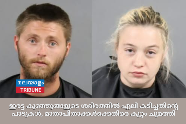 ഇരട്ട കുഞ്ഞുങ്ങളുടെ ശരീരത്തിൽ എലി കടിച്ചതിന്റെ പാടുകൾ,മാതാപിതാക്കൾക്കെതിരെ  കുറ്റം ചുമത്തി