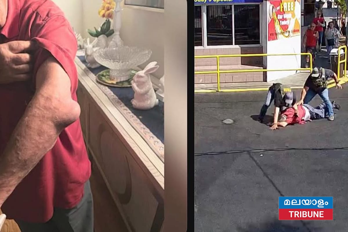 ICE റെയ്ഡ്: 79-കാരനായ യു.എസ്. പൗരന് പരിക്ക്, 50 മില്യൺ ഡോളർ നഷ്ടപരിഹാരം തേടി ക്ലെയിം ഫയൽ ചെയ്തു.