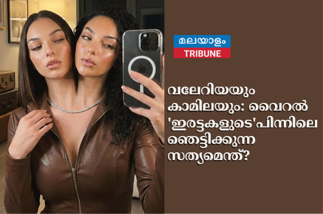 വലേറിയയും കാമിലയും: വൈറൽ 'ഇരട്ടകളുടെ' പിന്നിലെ ഞെട്ടിക്കുന്ന സത്യമെന്ത്?